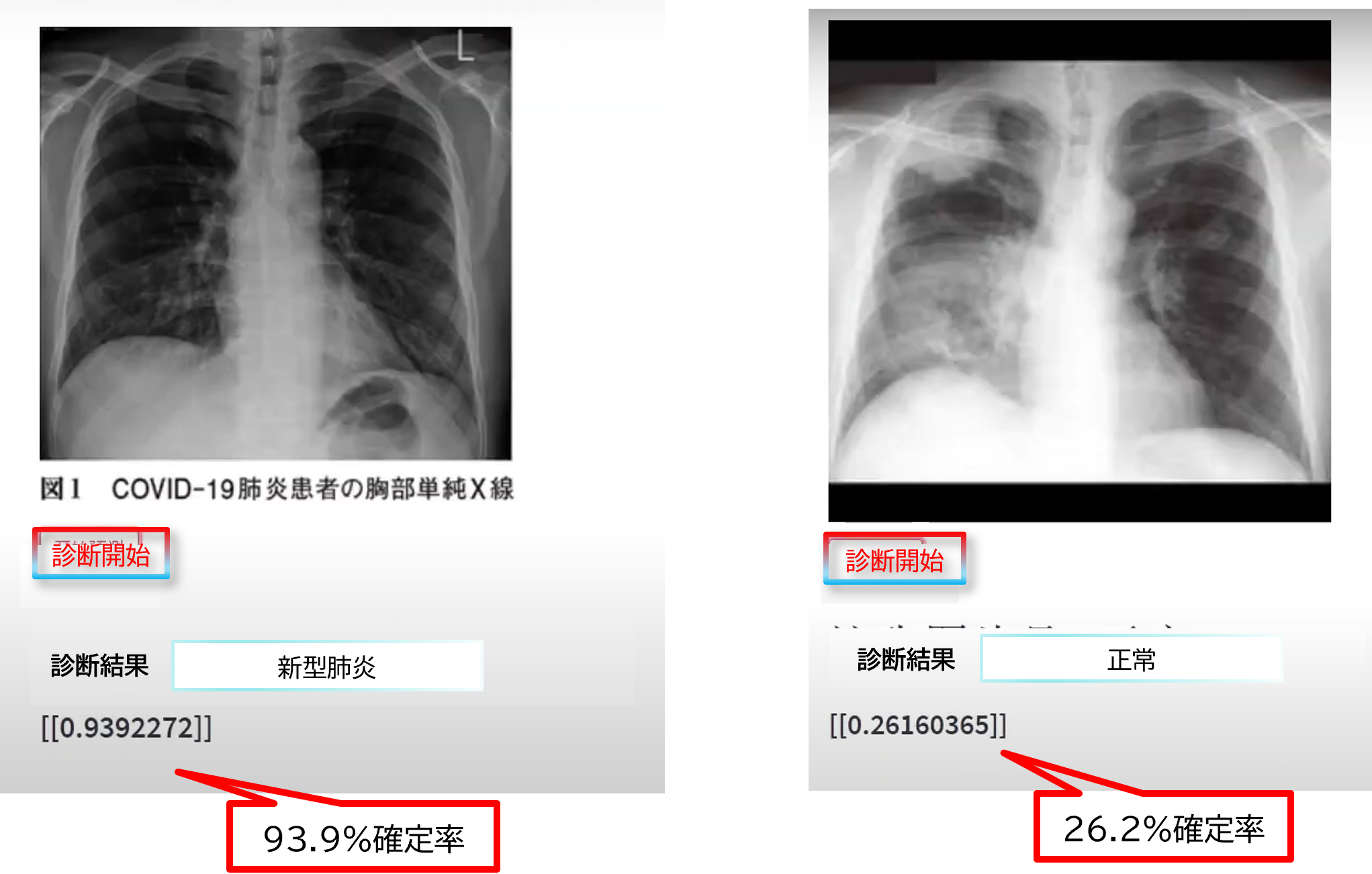 画像認識AI結果